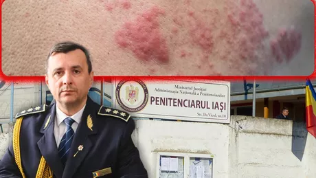 Strigăte de ajutor din lagărul din Copou. Deținuții de la Penitenciarul Iași s-au umplut de râie Este carne vie tot - FOTO