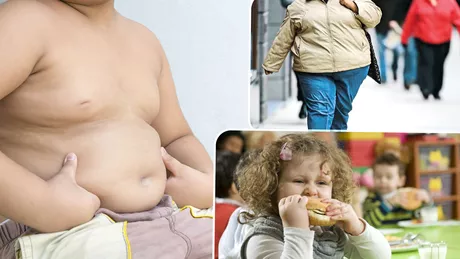 Până în anul 2035 numărul persoanelor care suferă de obezitate va crește într-un ritm accelerat. Specialiștii trag un semnal de alarmă - FOTO