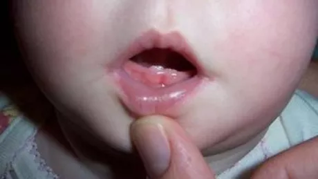 Cum calmezi rapid durerile de dinti la bebelusi
