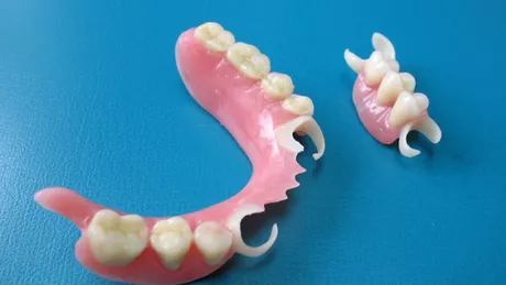 Ce sunt protezele dentare elastice