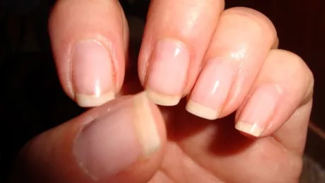4 factori care influenteaza cresterea unghiilor