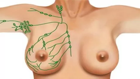Crioablatia o noua metoda disponibila de tratament a fibroadenomului mamar
