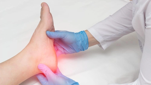 Cremă pentru fasceita plantară – Cum acționează și ce trebuie să conțină?