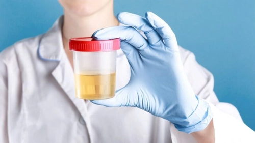 Ce afli dintr-un sumar de urină și urocultură și care este prețul, de fapt? Două analize care pot preveni complicații grave!