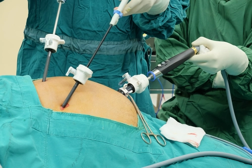medici in timpul unei operatii de hernie inghinală