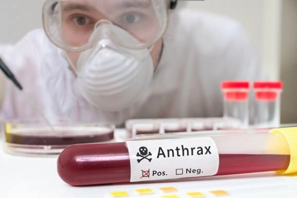 o mostră de sange prelevat de un pacient contaminat cu antrax