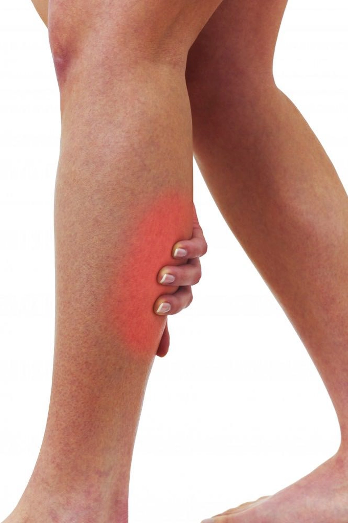 grafica persoana care se tine de picior din cauza celulitei infectioase