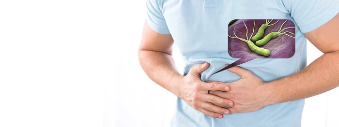 colaj persoana care sufera de dureri de burta cauzate de helicobacter pylori