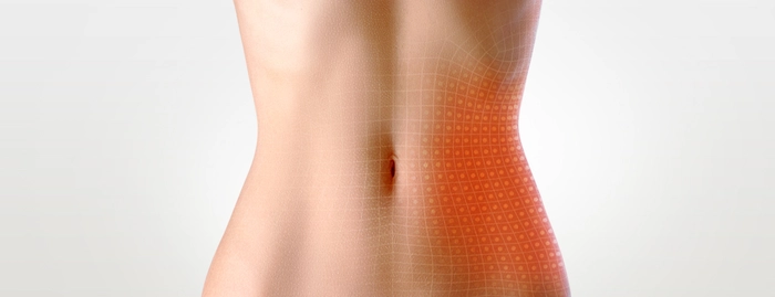 grafica femeie care sufera de dureri in jos sub burta in partea stanga