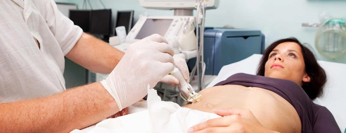 persoana ce vrea sa spuna m-am vindecat de ciroza hepatica și a venit la doctor