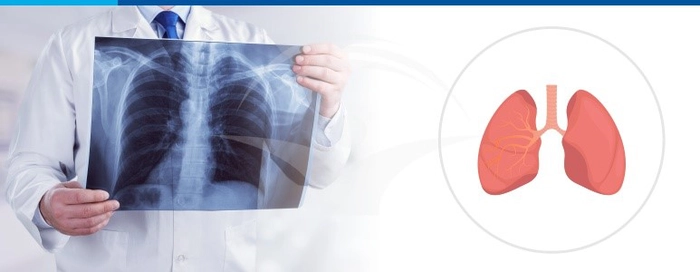  un medic care priveste o ecografie a unui pacient bolnav de tuberculoza