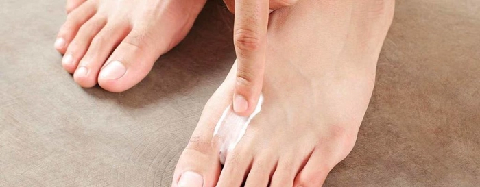 persoana care aplica crema intre degetele de la picioare