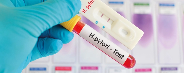 medic care tine in mana un test pentru helicobacter pylori