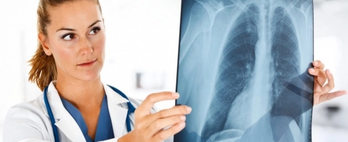 medic care priveste un rezultat de la rentghen