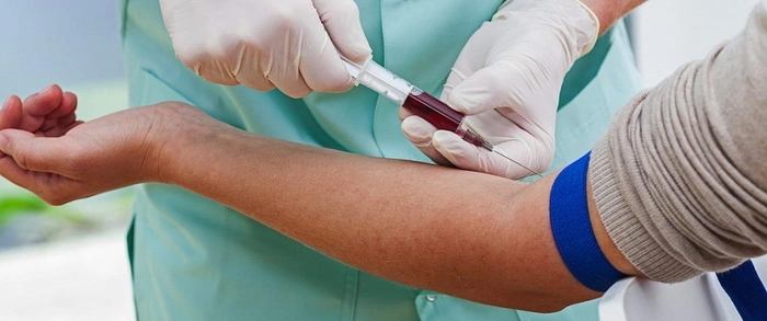 medic care ia sange din vena unei persoane pentru o analiza de sange