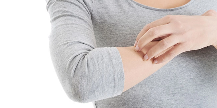 persoana care acuza mancarimi ale pielii