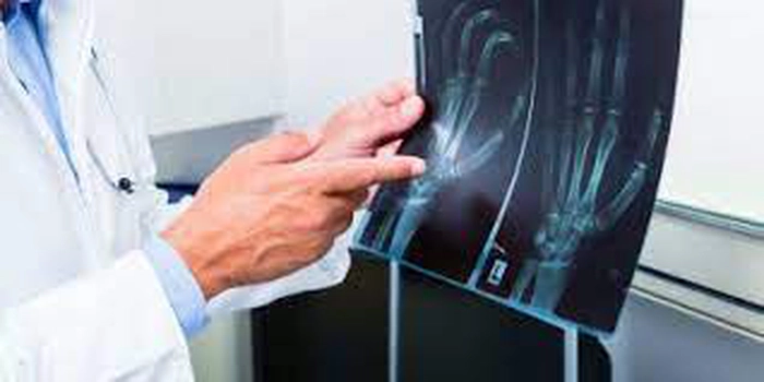  poză cu o radiografie