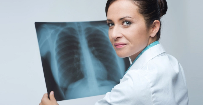 medic care priveste un rentghen la plamani