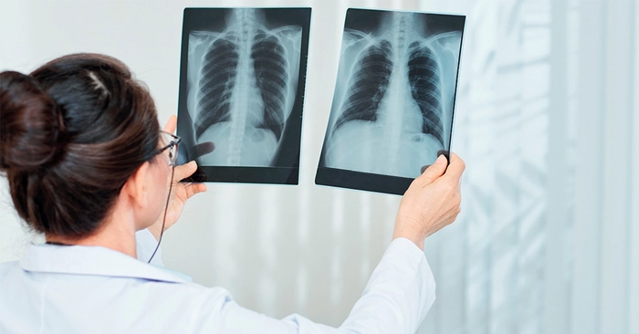 medic care priveste un rezultat de la rentghen