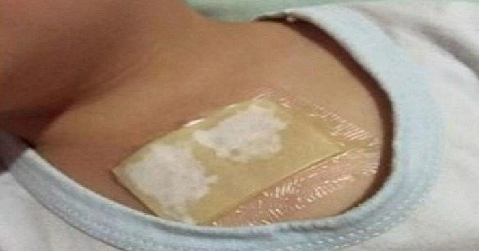 compresă pentru tuse pe pieptul unui copil