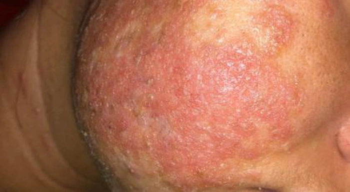 Persoana care a folosit schema de tratament prescrisa de Ioana Marinescu