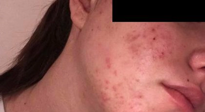 Persoana care a folosit schema de tratament prescrisa de Ioana Marinescu