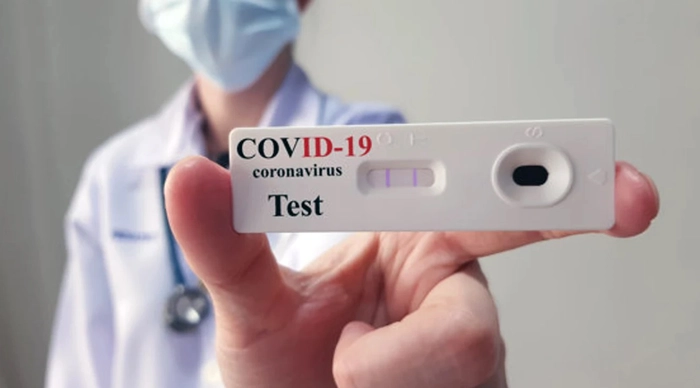  o imagine cu un test Covid