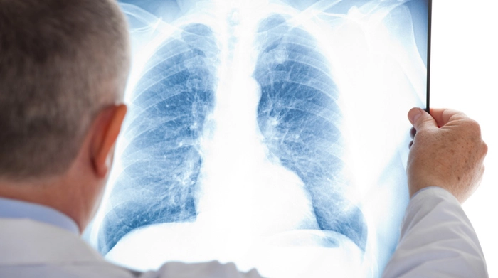 medic care priveste un rezultat de la rentghen