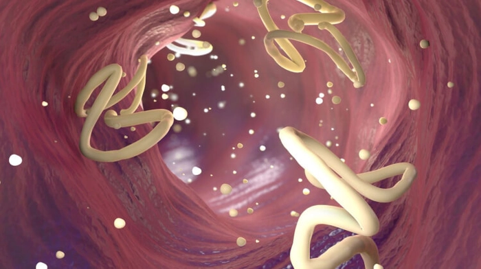viermi intestinali, viermisori la copii
