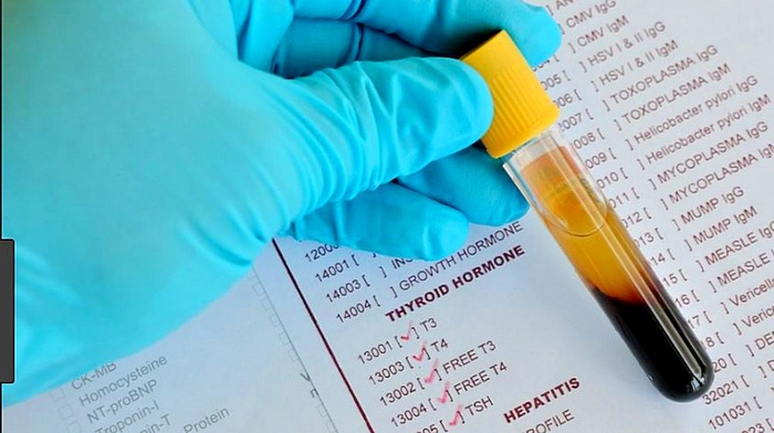 medic care tine in mana o eprubeta cu proba de sange