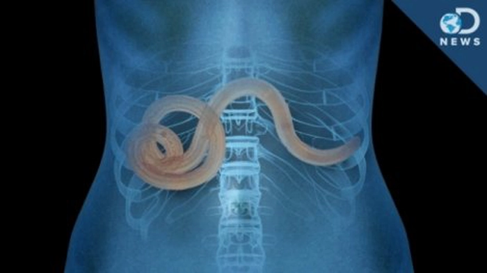 grafica viermi intestinali in intestinul unei persoane
