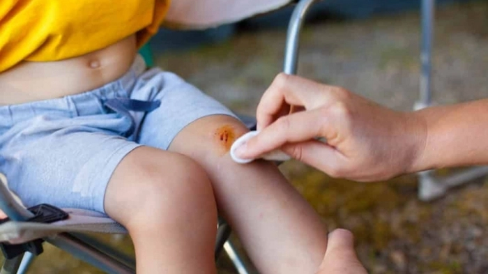 persoana care dezinfecteaza genunchiul lovit a unui copil