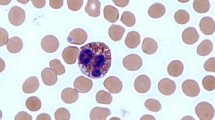 molecula de eozinofila la nivelul microscopului