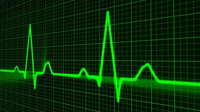 reprezentare rim cardiac