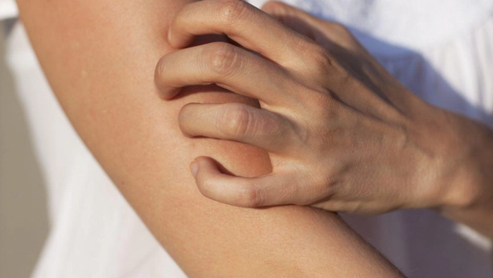 persoana care se scarpina pe piele