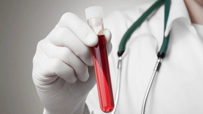 doctor care tine in mana o eprubeta cu proba de sange