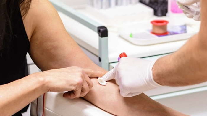 medic care recolteaza sange pentru analiza