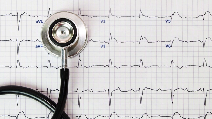 un rezultat de la ekg si un stetoscop 