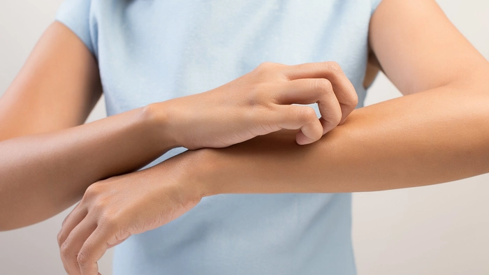 femeie care sufera de mancarimi a pielii