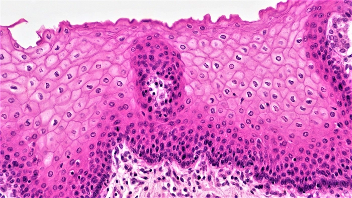 celule epiteliale la nivel microscopic