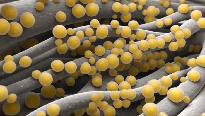 stafilococ auriu la microscop