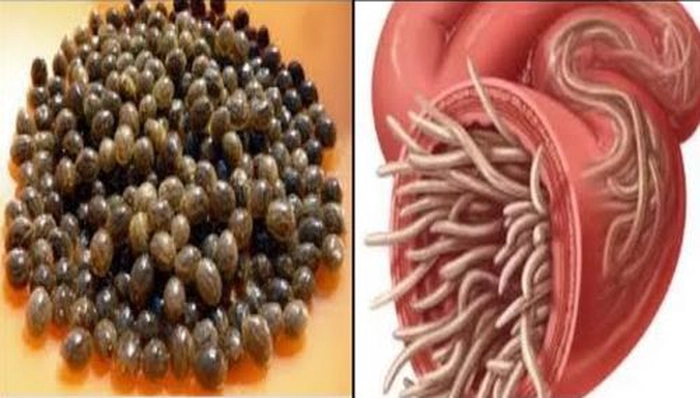 viermi intestinali