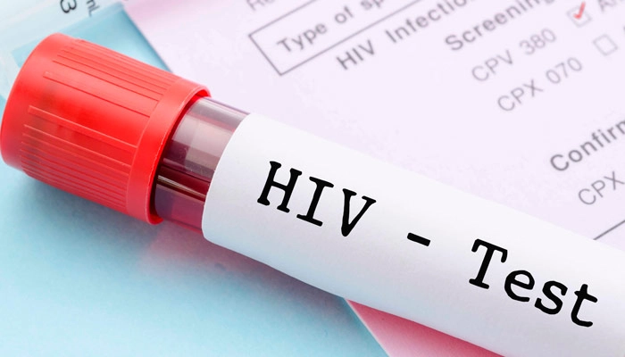 un test hiv