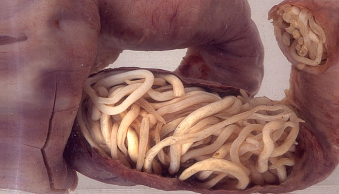 viermi intestinali