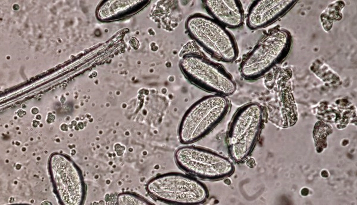imagine la microscop a ouălor parazite
