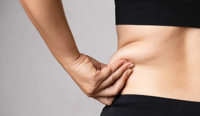 femeie care se tine de excesul de greutate depus pe lateral