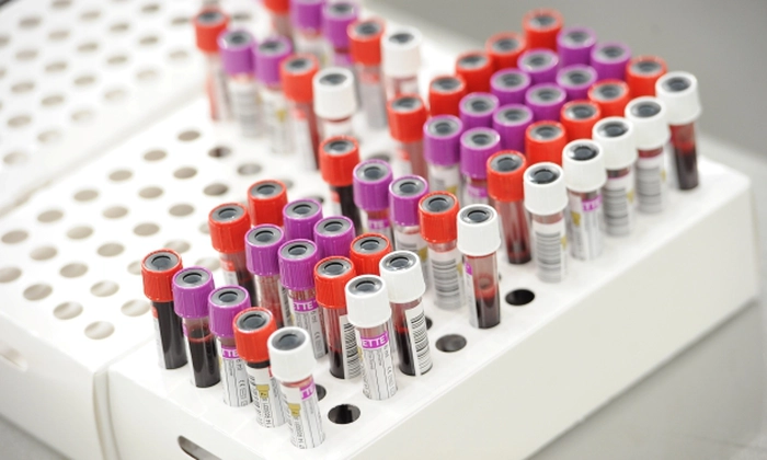 imagine recipiente de recoltare analize medicale