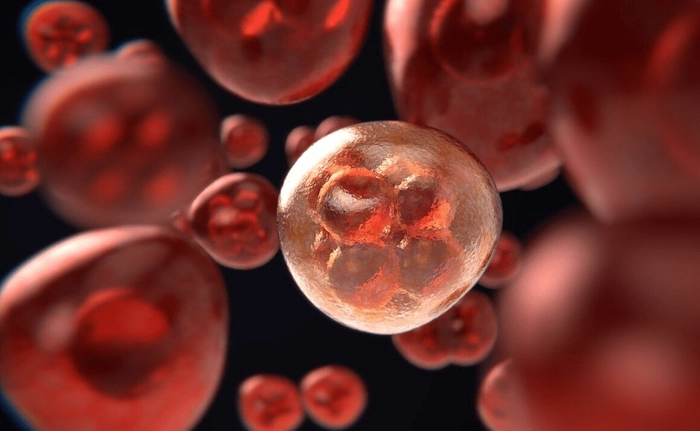 celule pancreatice canceroase