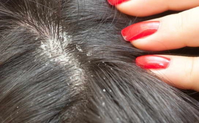 scalp, par brunet, unghii rosii