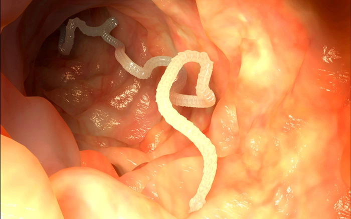 paraziți intestinali